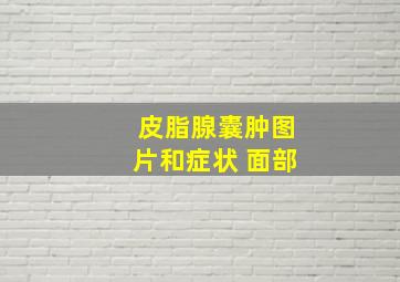 皮脂腺囊肿图片和症状 面部